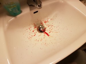 20170301_185925.jpg