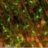 dendrite